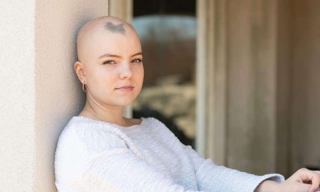 girl sitting against a wall with a patchy spot of short hair in front of her head showing signs of alopecia